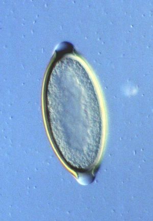 Trichuris vulpis